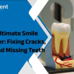 The Ultimate Smile Makeover